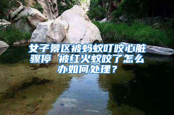 女子景區(qū)被螞蟻叮咬心臟驟停 被紅火蟻咬了怎么辦如何處理？